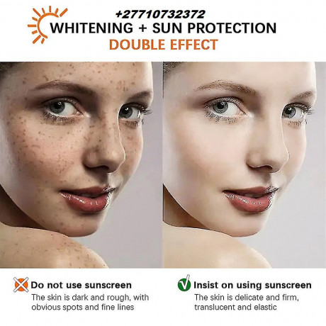 skin-whitening-products-in-serangoon-town-in-singapore-call-27710732372-scarsstretch-marks-removal-in-rustenburg-south-africa-big-2