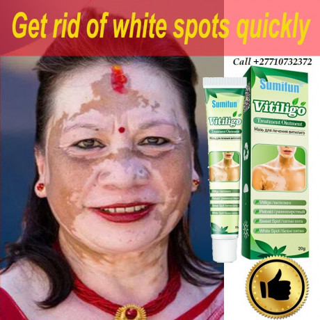 skin-whitening-products-in-serangoon-town-in-singapore-call-27710732372-scarsstretch-marks-removal-in-rustenburg-south-africa-big-0