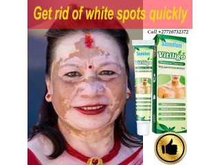 +2771 073 2372 Get Rid Of Vitiligo In West Melbourne City in Florida And Vaasa City In Finland