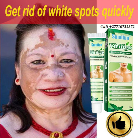 2771-073-2372-get-rid-of-vitiligo-in-west-melbourne-city-in-florida-and-vaasa-city-in-finland-big-0