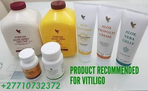 2771-073-2372-get-rid-of-vitiligo-in-west-melbourne-city-in-florida-and-vaasa-city-in-finland-big-2